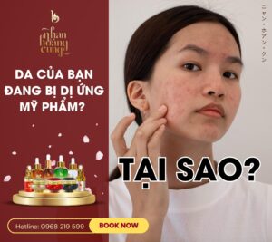 điều trị da bị dị ứng mỹ phẩm